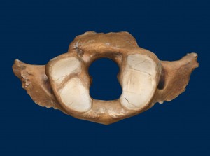 Buesching Cervical Vertebra 1(atlas)